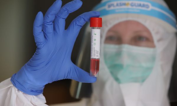 Mbi 175 milion raste me Covid-19 në mbarë botën