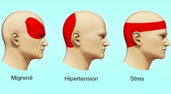 Mësoni se pse keni dhimbje koke