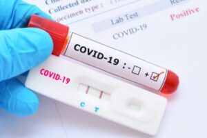 74 raste aktive me COVID-19 në Kosovë