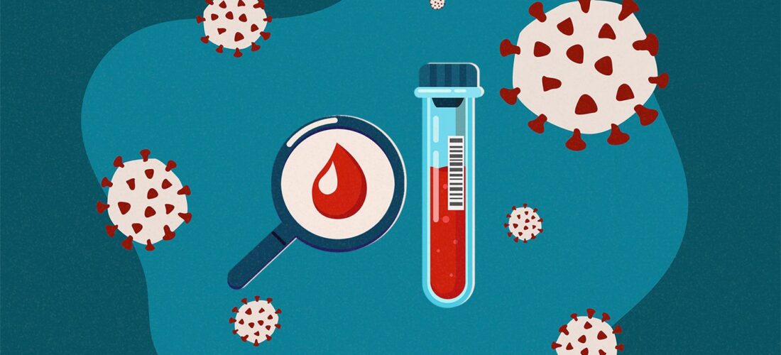 32 raste të reja me coronavirus në Kosovë