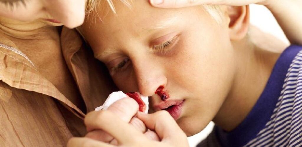 Si trajtohet gjakderdhja nga hunda dhe cilët janë shkaktarët?