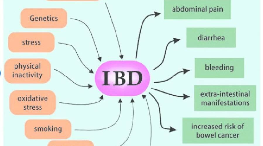 19 Maji, Dita Ndërkombëtare e Sëmundjeve Inflamatore e Zorrëve