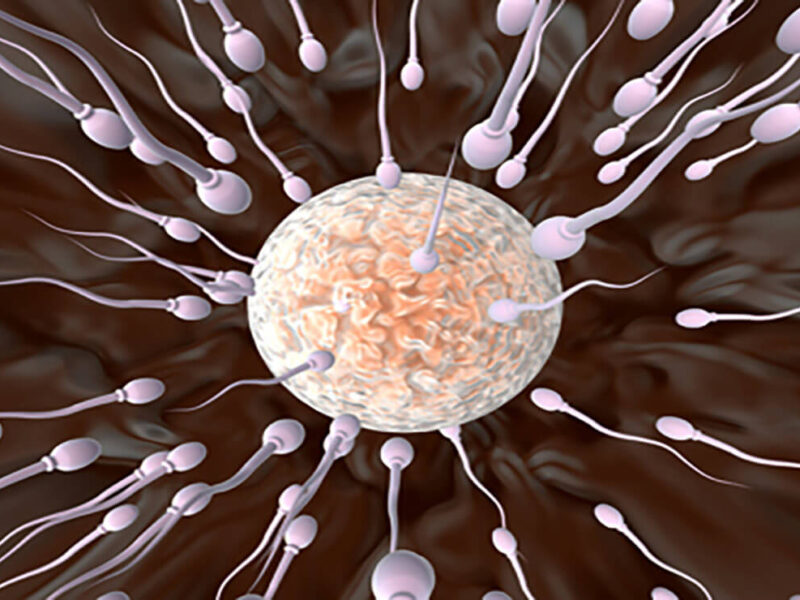 Arsyjet më të shpeshta të paraqitjes së infertilitetit tek meshkujt