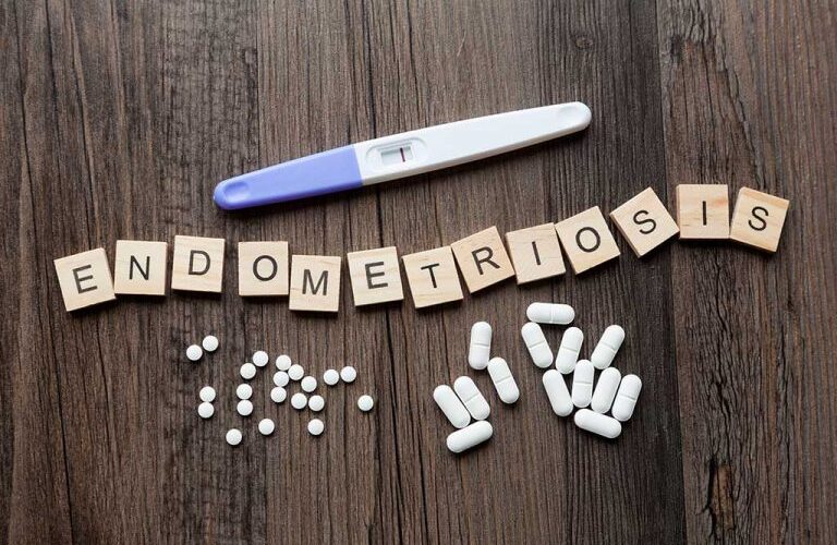 Simptomat me të cilat mund të përballeni gjersa keni endometriozë