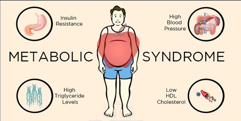 Çfarë duhet të dini për sindromin metabolik?