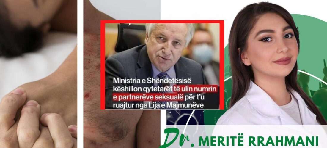 Rreth deklaratës së Ministrit Latifi se Lija e Majmunëve mund të transmetohet përmes mardhenieve seksuale – sjellë kundërfakte, Dr.Meritë Rrahmani