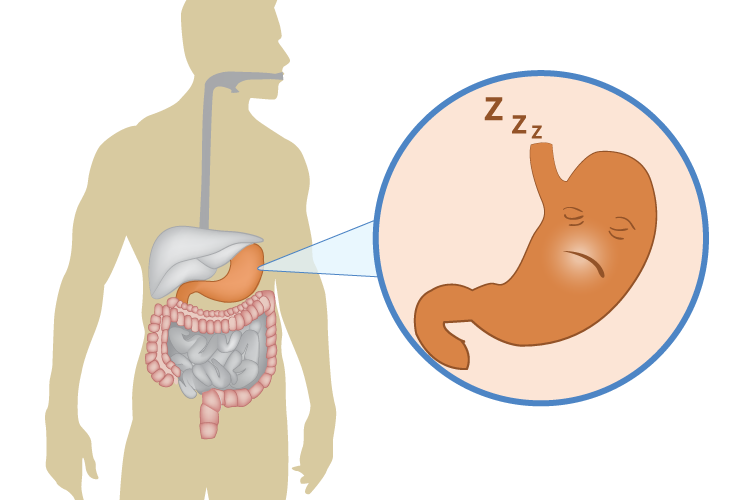 Gastropareza: Simptomat, Diagnostifikimi dhe Trajtimi