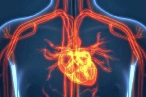Shenjat paralajmëruese të arterieve të bllokuara dhe si t’i mbroni ato