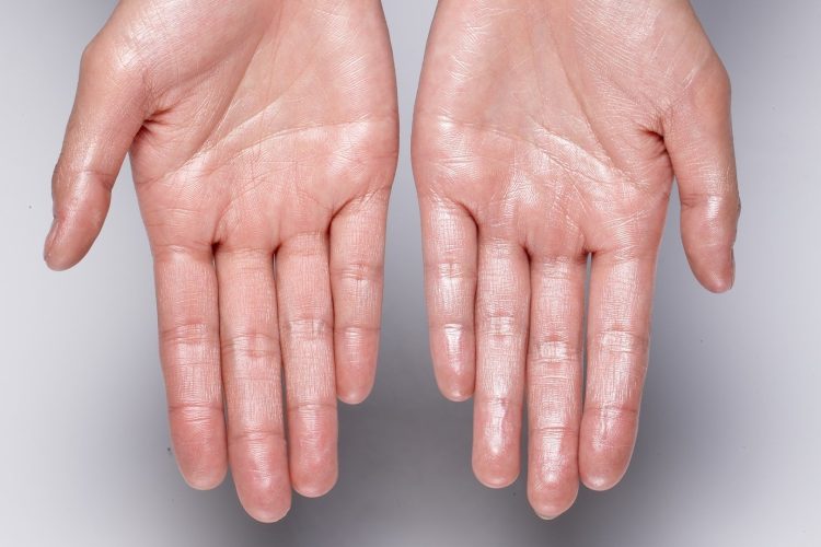 Çfarë e shkakton kruajtjen e lëkurës? Hulumtimi i ri tregon një faktor të panjohur më parë