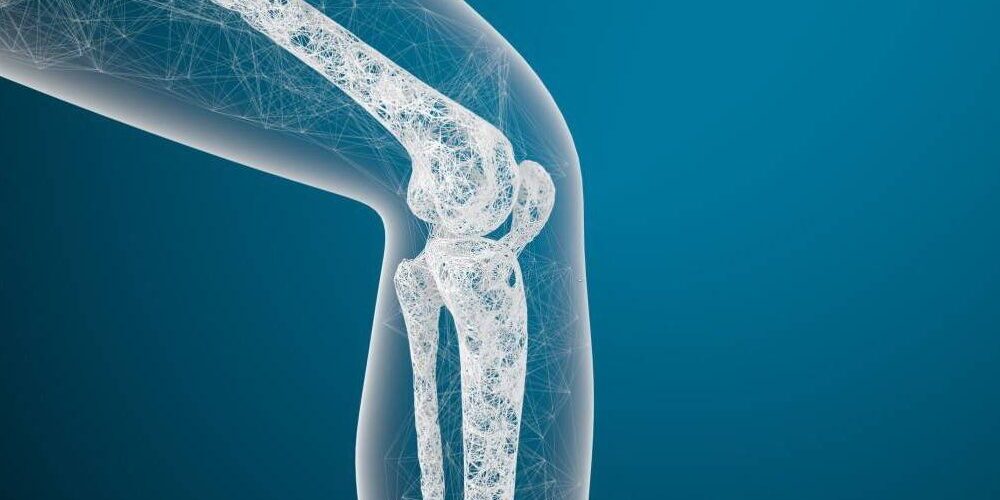 Lidhja mes Artritit dhe Osteoporozës tek Gratë – Këshillat e Mjekëve