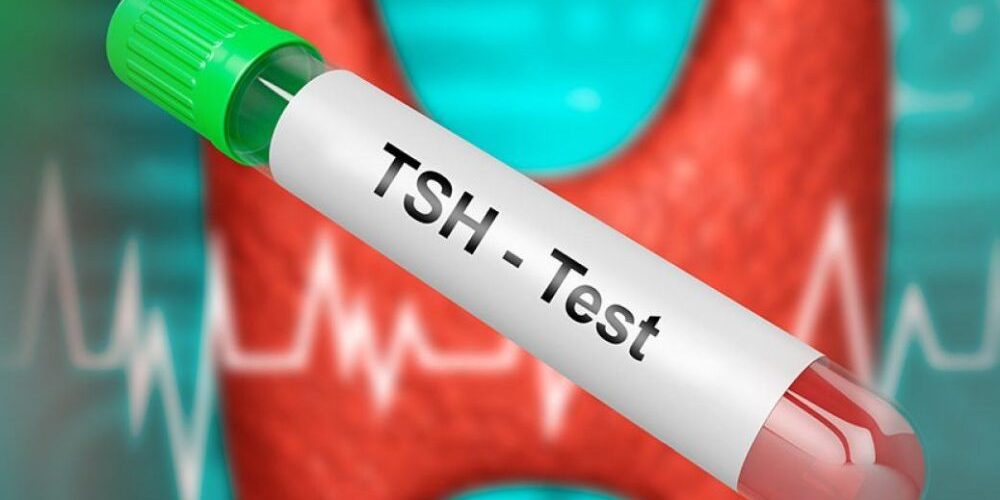 Llojet e testeve të tiroides – Pse është e rëndësishme t’i bëni?