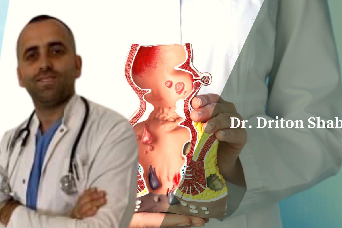 Se si të parandalohet përsëritja e hemorroideve – tregon gastroenterologu, Driton Shabani