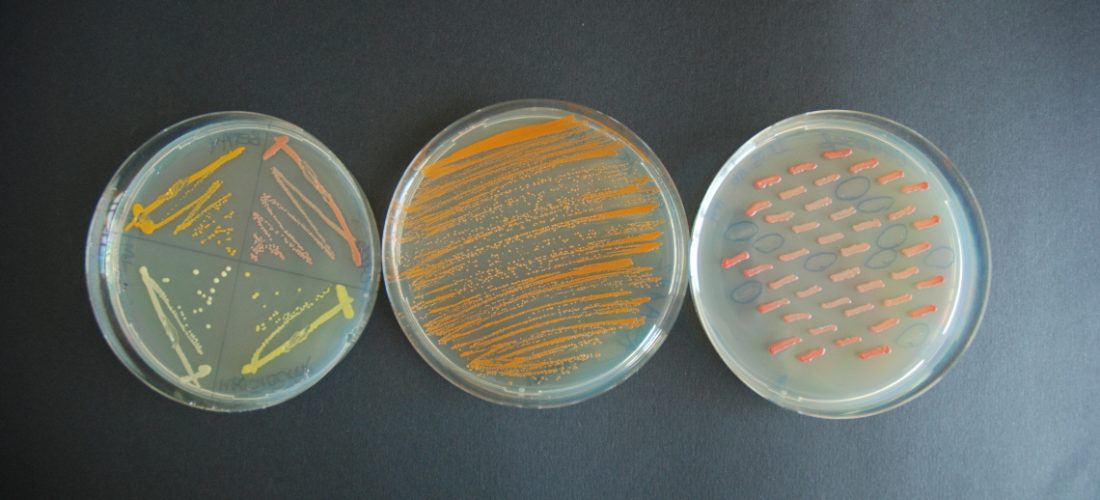 Sendet personale që mbajnë më shumë mikrobe