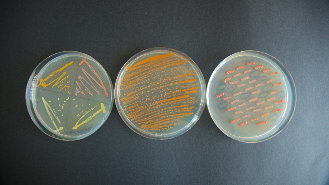 Sendet personale që mbajnë më shumë mikrobe