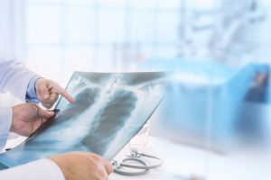 A është pneumonia ngjitëse? Kush është më i rrezikuar dhe si mund të parandalohet?