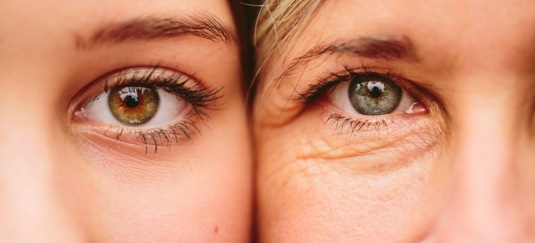 Si t’i Eliminoni Rrudhat Poshtë Syve