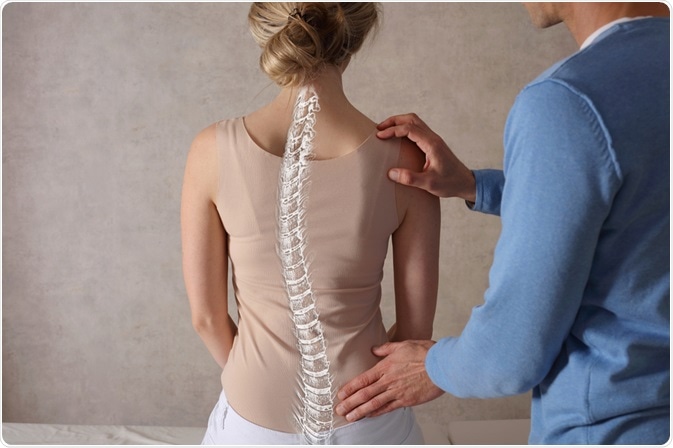 Sindroma Marfan: Simptomat, Diagnostikimi dhe Trajtimi