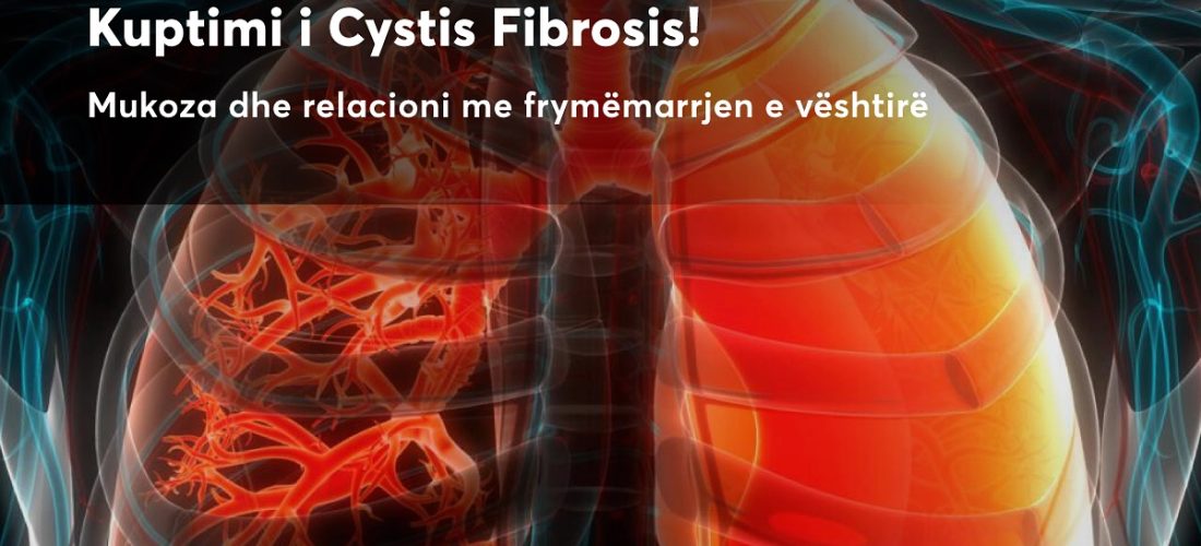 Çka është Fibroza Cistike? – Pinea Medical Center