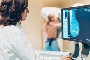 Pse Gratë në Moshën 40 Vjeçare Duhet të Bëjnë Rregullisht Mamografi?
