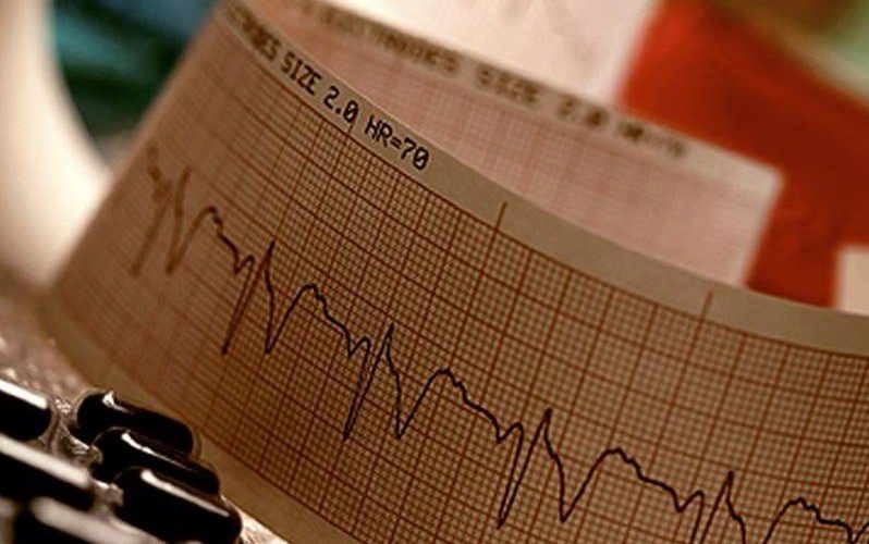 Fibrilacioni atrial po bëhet më i zakonshëm tek njerëzit e moshës së mesme