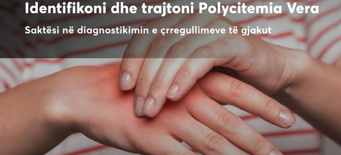 Diagnostikimi i Avancuar i Polycitemia Vera në Pinea Medical Center