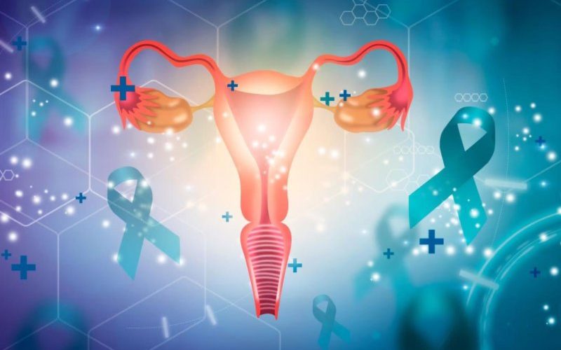 Endometrioza lidhet me shanse shumë më të larta për kancer të vezoreve