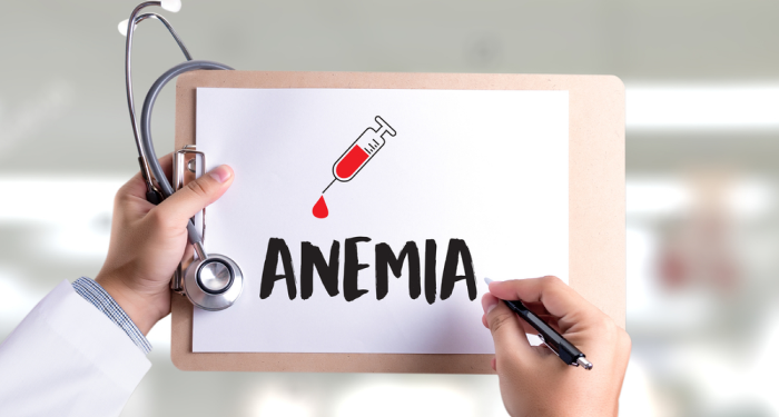 Ushqimet më të nevojshme për ata që vuajnë nga anemia
