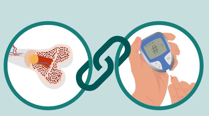 Diabeti  i bën kockat të brishta (rrezikon për fraktura)