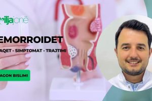 Dr. Agon Bislimi: Hemorroidet, shkaqet, simptomat dhe trajtimi