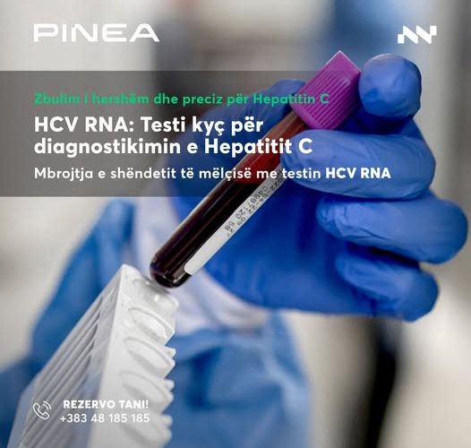 Kujdesuni për shëndetin e mëlçisë: Rezervoni Testin HCV RNA sot!