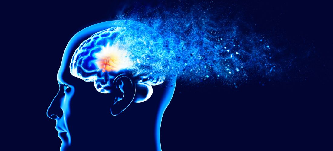 Studim: Infeksioni kronik i zorrëve ndikon në shfaqjen e Alzheimerit