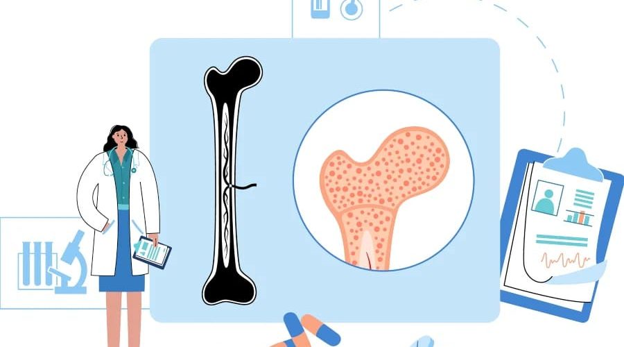 Rehabilitimi me implante dentare te pacientët e trajtuar me bifosfonate