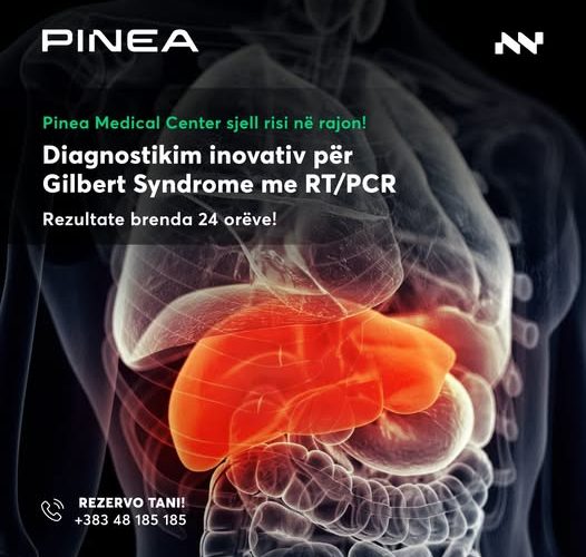 Pinea Medical Center ofron testimin më inovativ për Gilbert Syndrome