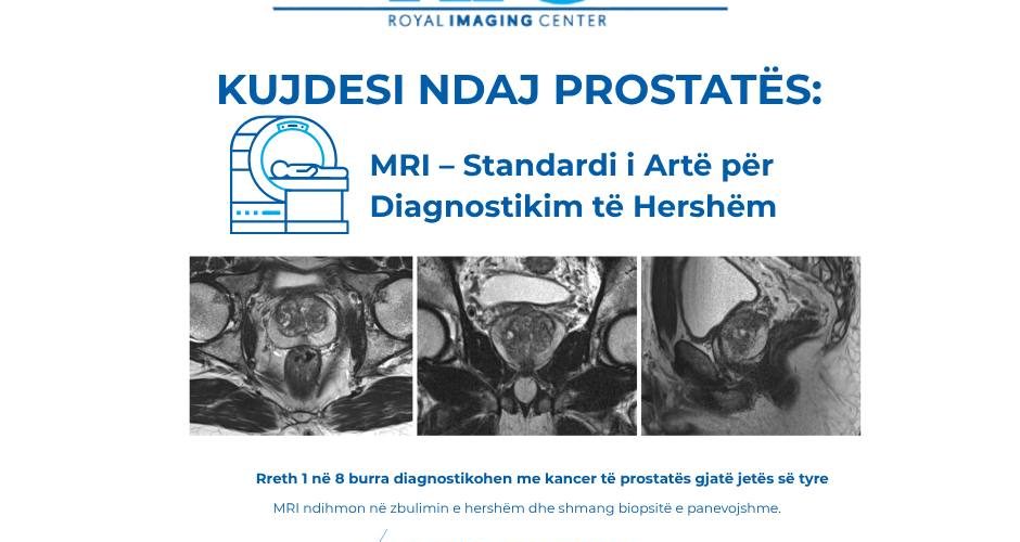 Shëndeti i prostatës nuk pret – MRI, hapi i mençur për diagnostikim të saktë!