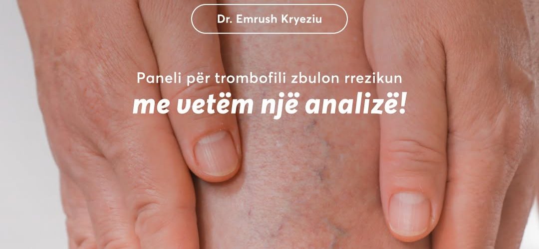 A jeni në rrezik për trombozë? Prof. Dr. Emrush Kryeziu ju ndihmon ta zbuloni me një test të vetëm
