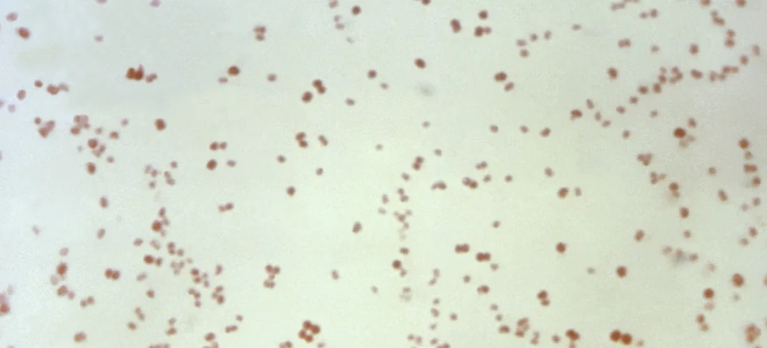 Krijohen antibiotikë të rinj me inteligjencë artificiale kundër gonorresë dhe bakterit MRSA