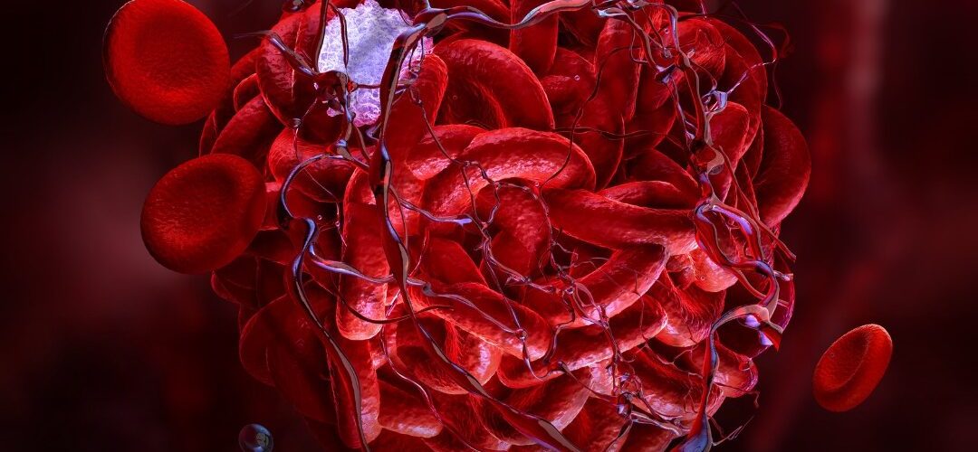 Studim: Agjërimi ul rreziqet nga infarkti