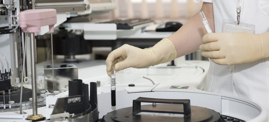 Mbi 260 pacientë kryejnë analiza mjekësore çdo ditë në Spitalin e Përgjithshëm