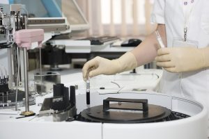 Analiza e re e gjakut mund të ndihmojë në parashikimin e rrezikut për sëmundjen Alzheimer