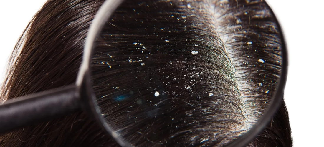 Ja si mund ta përmirësoni zbokthin me produkte që mund t’i keni në shtëpi