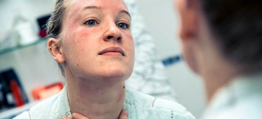 Shenjat që tregojnë se keni mungesë të vitaminës B6