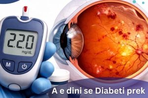 A e dini se Diabeti prek edhe sytë tuaj? – Klinika Gjermane e Syrit ofron zgjidhje për këtë!