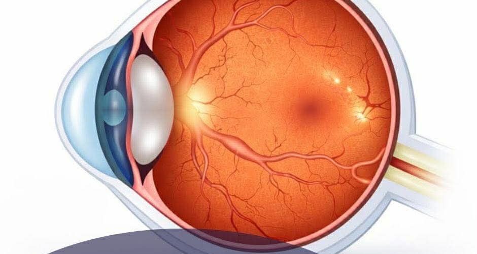 A e dini që disa sëmundje të retinës mund të përparojnë “pa dhimbje”, por me rrezik për shikimin?