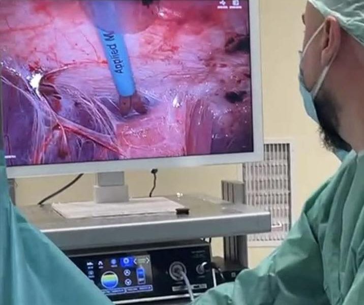 Falë kirurgjisë moderne në Spitalin Rezonanca 2, pacientja shpëton pas dekadash komplikimesh