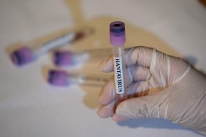 Hantavirusi, Agjencia amerikane e shëndetësisë: Reagim emergjent i “Nivelit 3”
