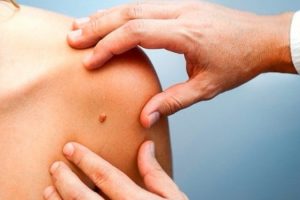 9 simptomat e kancerit që nuk duhet t’i injoroni