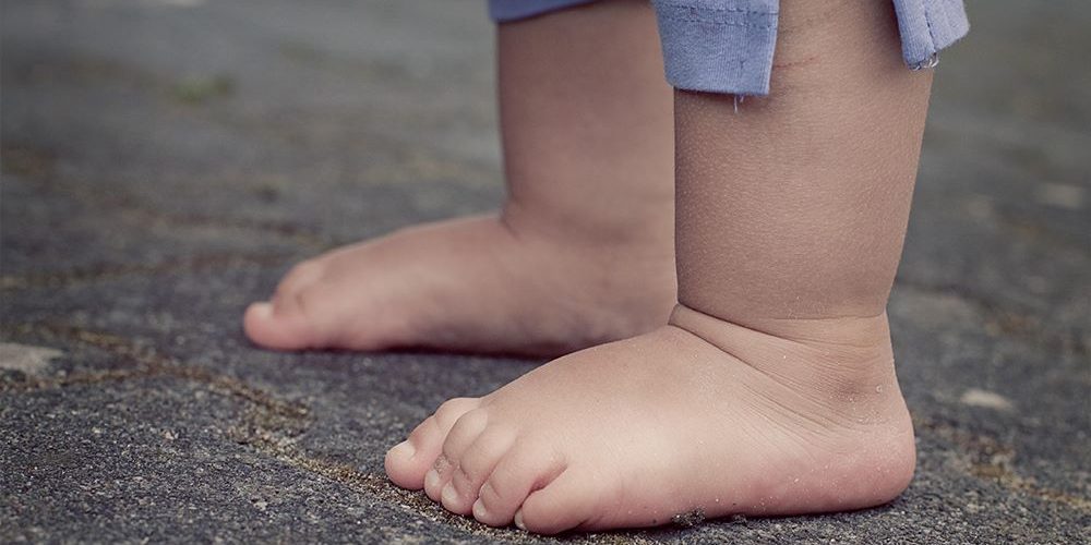 Shputat e rrafshëta tek fëmijët – kur janë normale dhe kur duhet kontrolluar?