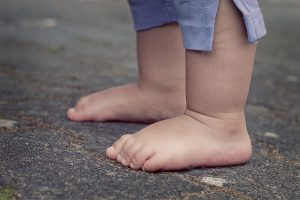 Shputat e rrafshëta tek fëmijët – kur janë normale dhe kur duhet kontrolluar?