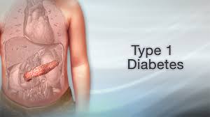 Një hap historik në luftën kundër diabetit të tipit 1