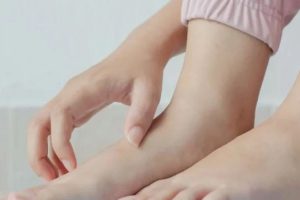 Kruarja e këmbëve – Kur mund të jetë shenjë e problemeve shëndetësore